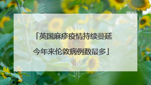 英国麻疹疫情持续蔓延 今年来伦敦病例数最多
